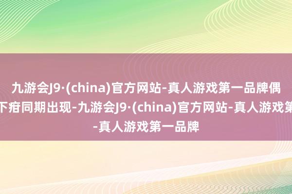 九游会J9·(china)官方网站-真人游戏第一品牌偶可与硬下疳同期出现-九游会J9·(china)官方网站-真人游戏第一品牌